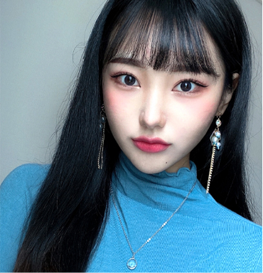 輪郭トックスで顔の脂肪を除去しVライン小顔になったモデル