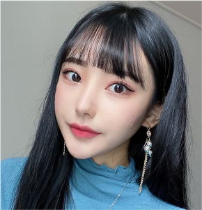 輪郭トックスで顔の脂肪を減らしフェイスラインが整った変化結果