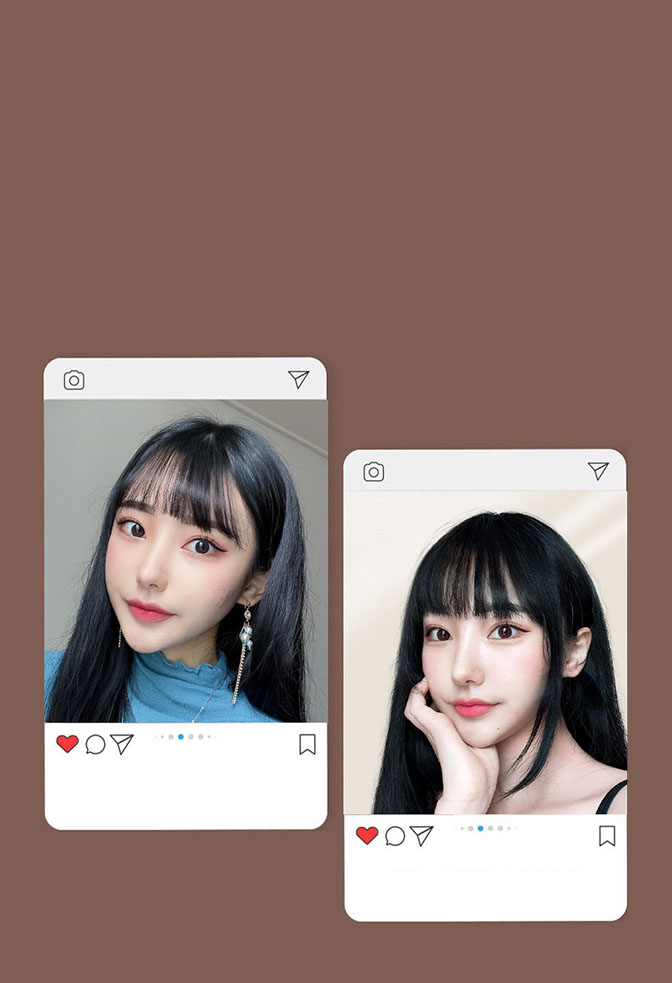 SNSでid輪郭4種施術の変化を共有した投稿