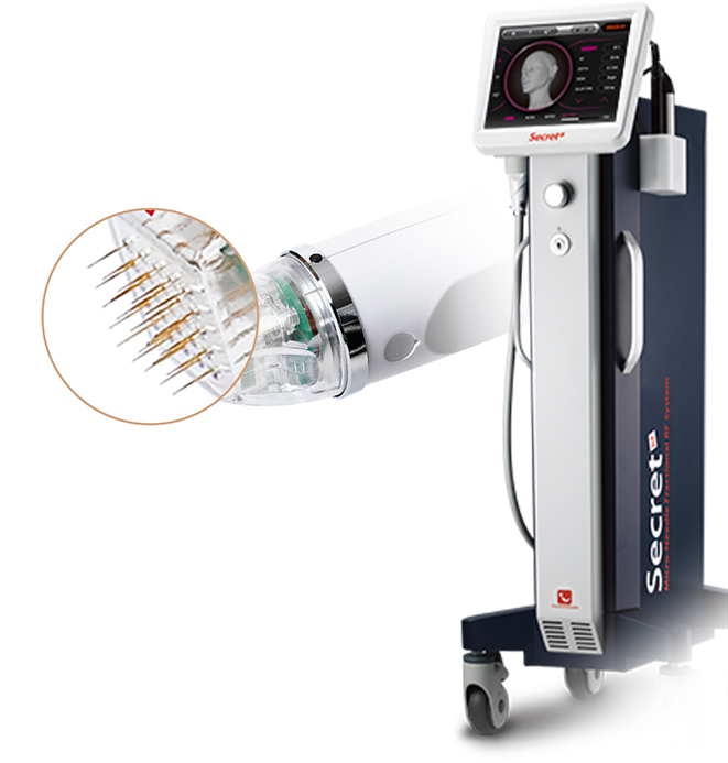 毛穴・痕跡を消すシークレットレーザー機器とマイクロ再生細胞ニードルの詳細写真