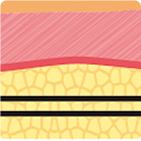 第1世代から第4世代まで進化したスレッドリフト構造
