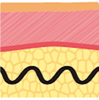 第1世代から第4世代まで進化したスレッドリフト構造