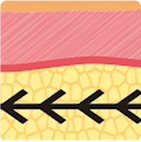 第1世代から第4世代まで進化したスレッドリフト構造