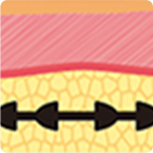 第1世代から第4世代まで進化したスレッドリフト構造