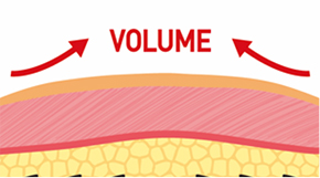 一般のスレッドリフトとは異なり コーンが移動できるため神経刺激がない原理を説明